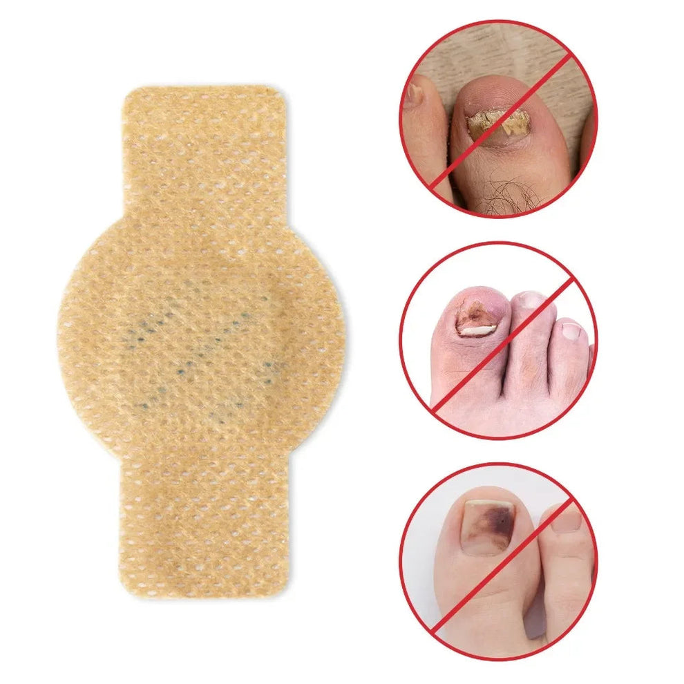 Fungal Nail Patches