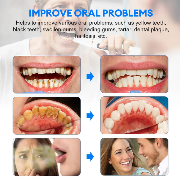 Electric Teeth Cleaner & Stain Remover